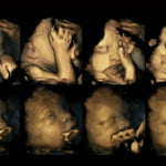 Ecografía revela cómo reacciona un feto cuando la madre lo contamina con su cigarro