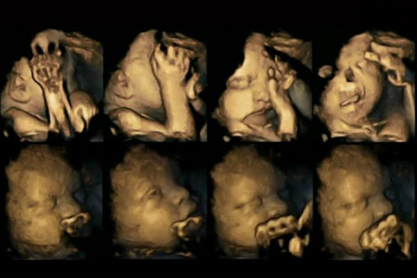 Read more about the article Ecografía revela cómo reacciona un feto cuando la madre lo contamina con su cigarro