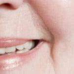 Arrugas alrededor de la boca ¿Por qué aparecen y cómo tratarlas?