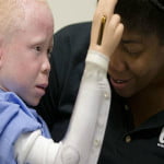 La historia del niño albino Baraka Cosmas asoma un final esperanzador