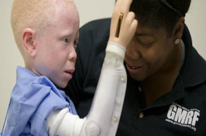 Read more about the article La historia del niño albino Baraka Cosmas asoma un final esperanzador