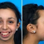 ¡No podrás creer lo cambiada que quedó esta joven después de operarse la mandíbula!