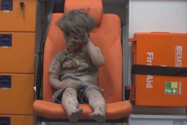 You are currently viewing Después de un ataque este niño sirio se convirtió en símbolo